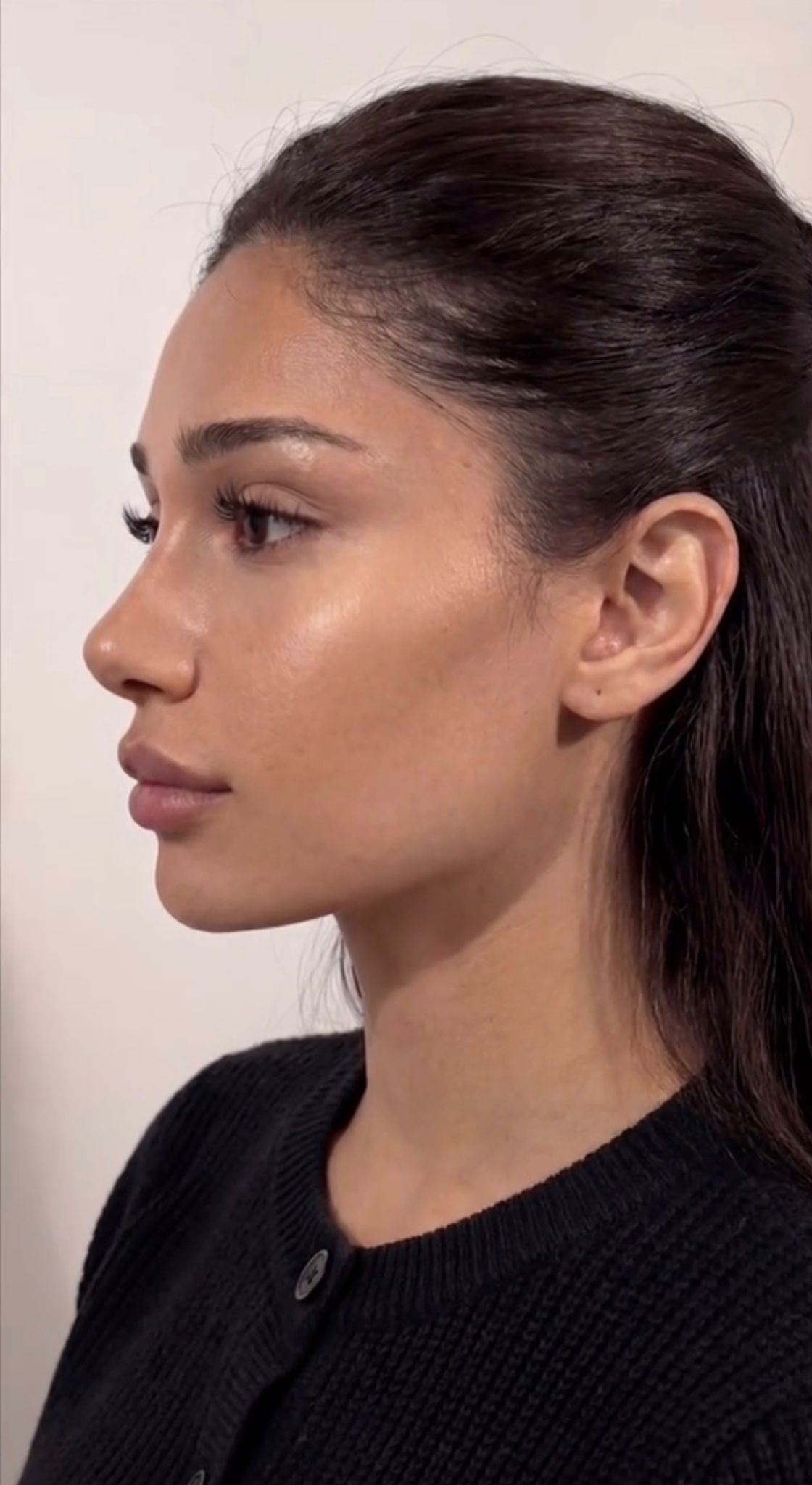 River Oaks facial balancing result